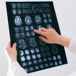 Coupons and Your Brain: 10 Reasons Deals Can Feel Addictive