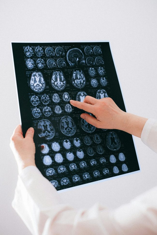 Coupons and Your Brain: 10 Reasons Deals Can Feel Addictive
