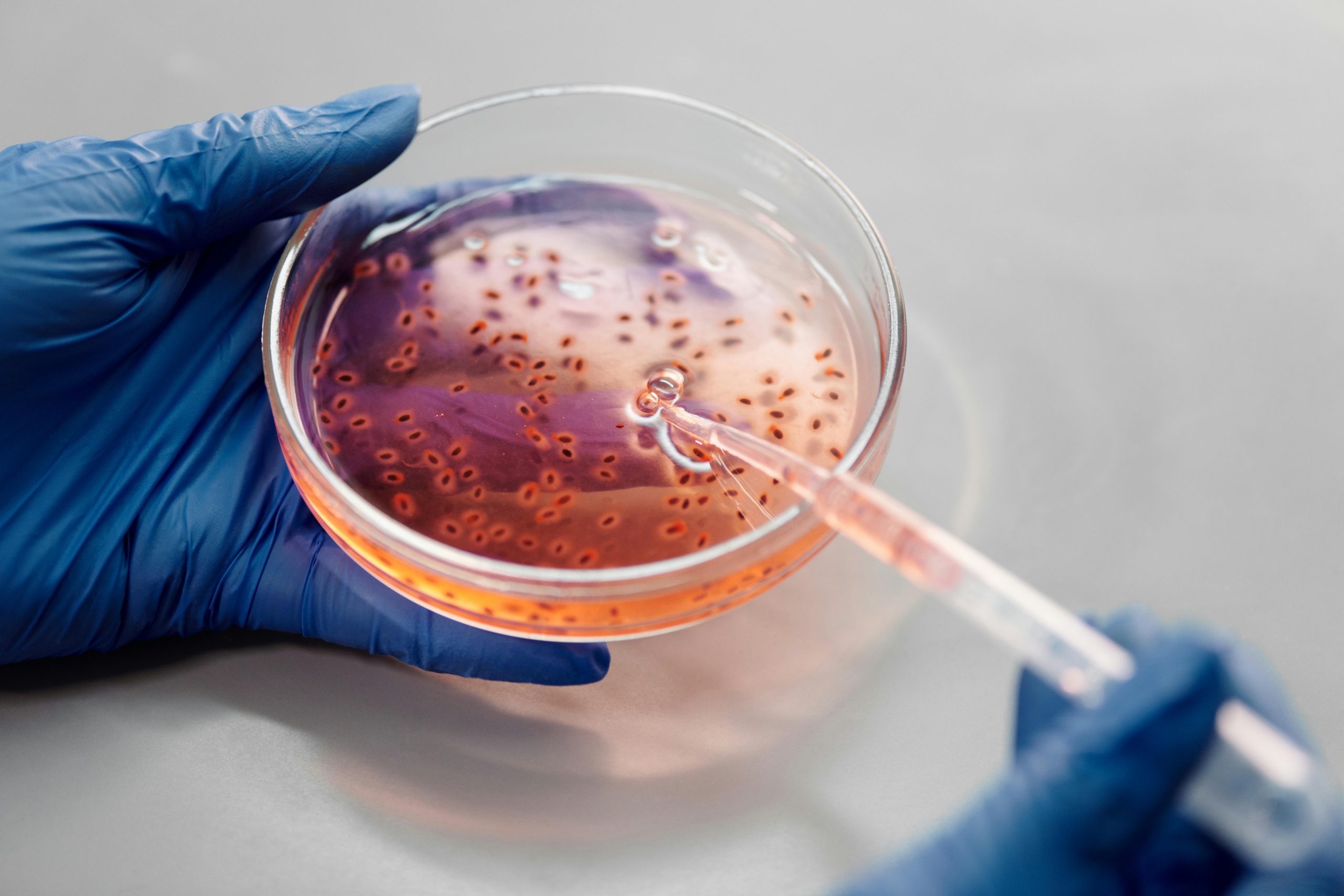 5 Types of Food Safety Issues the FDA Routinely Monitors