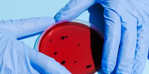 8 Foods That Were Pulled for Contamination But Came Back Without Warning